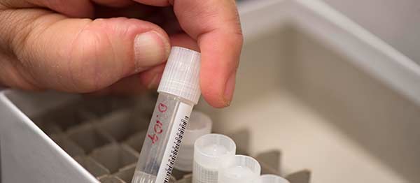 The tissue bank at Harper Cancer Research Institute