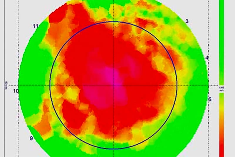 A sonic tomograph scan of a tree.