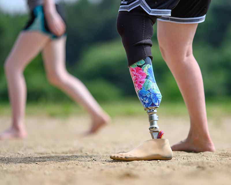 A detail shot of a floral and colorful prosthetic lower-leg.