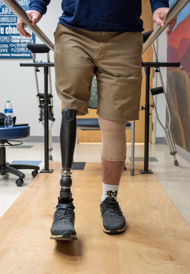 A close up Andrew's legs from the waist down. He's wearing shorts and his new prosthetic leg is visible.