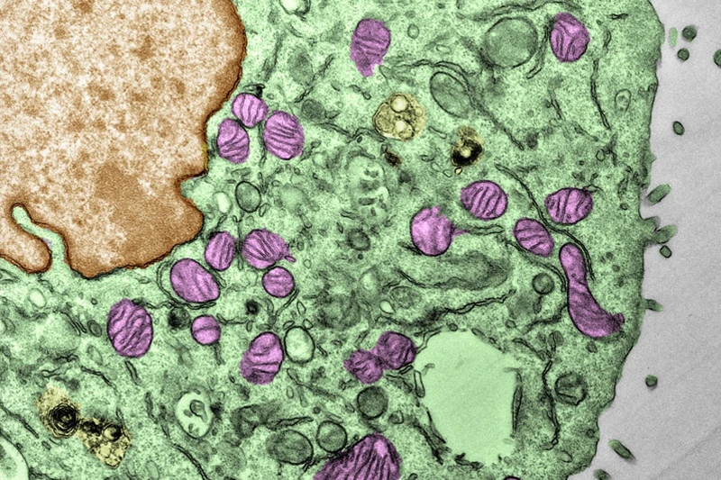 Electron micrograph of mitochondria (pink/purple color) from cancer cells resistant to immune checkpoint inhibitors