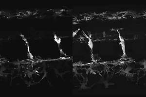 Microsope images, the right image clearer than the left