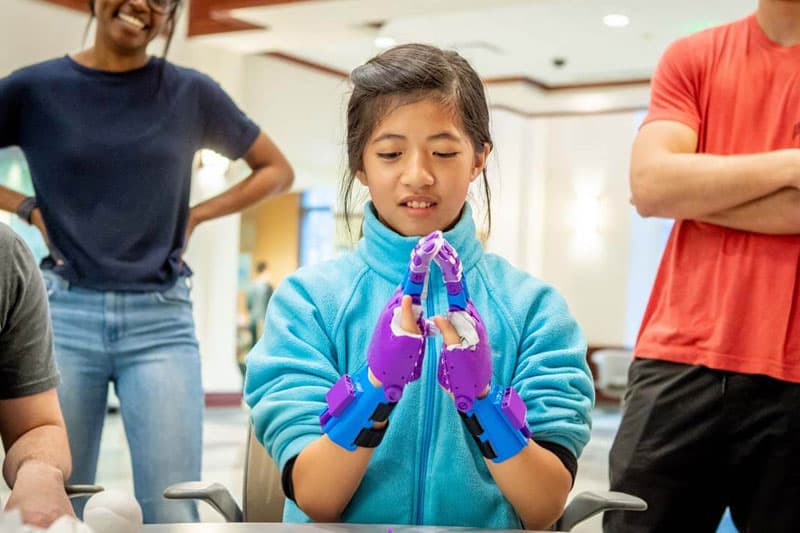 A woman tries the first of a pair of 3D-printed prosthetic hands.