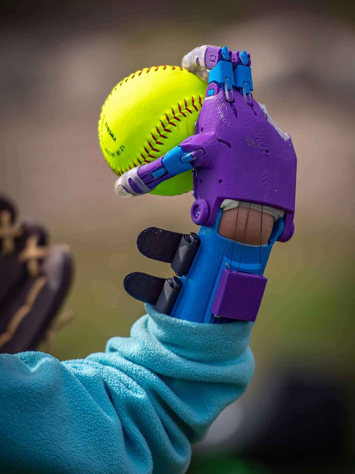 Tori throwing a softball with her new prosthetic hands.