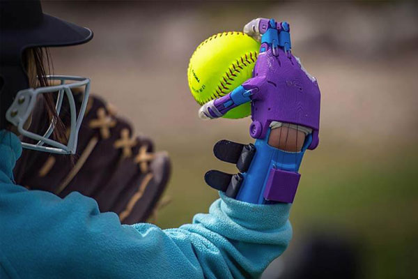A prosthetic arm holds a softball.